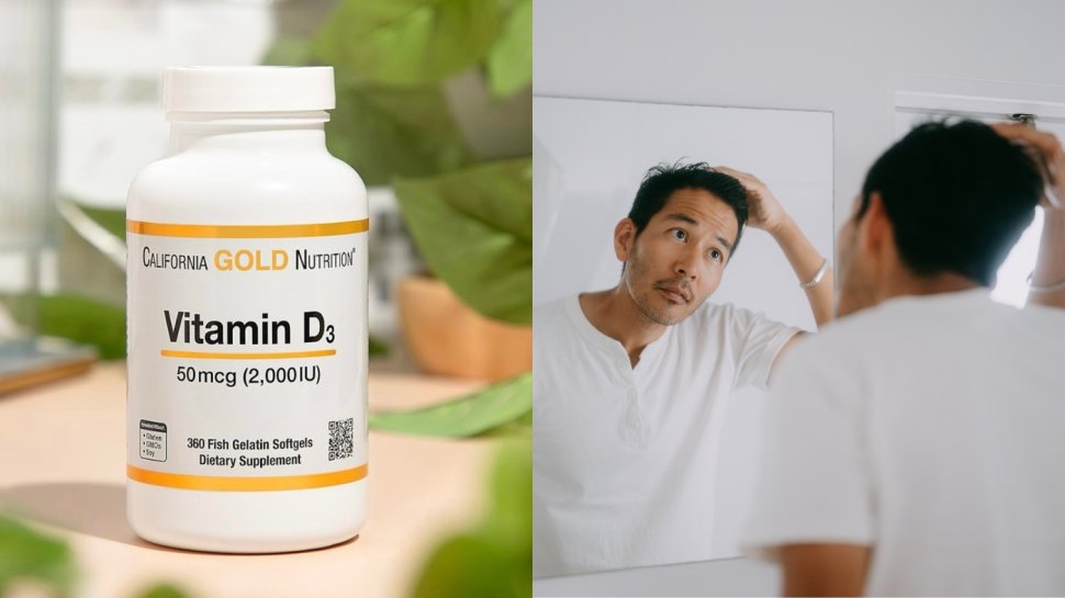 鬼剃頭成因｜鬼剃頭維他命/洗頭水/藥膏全攻略！附鬼剃頭食療清單